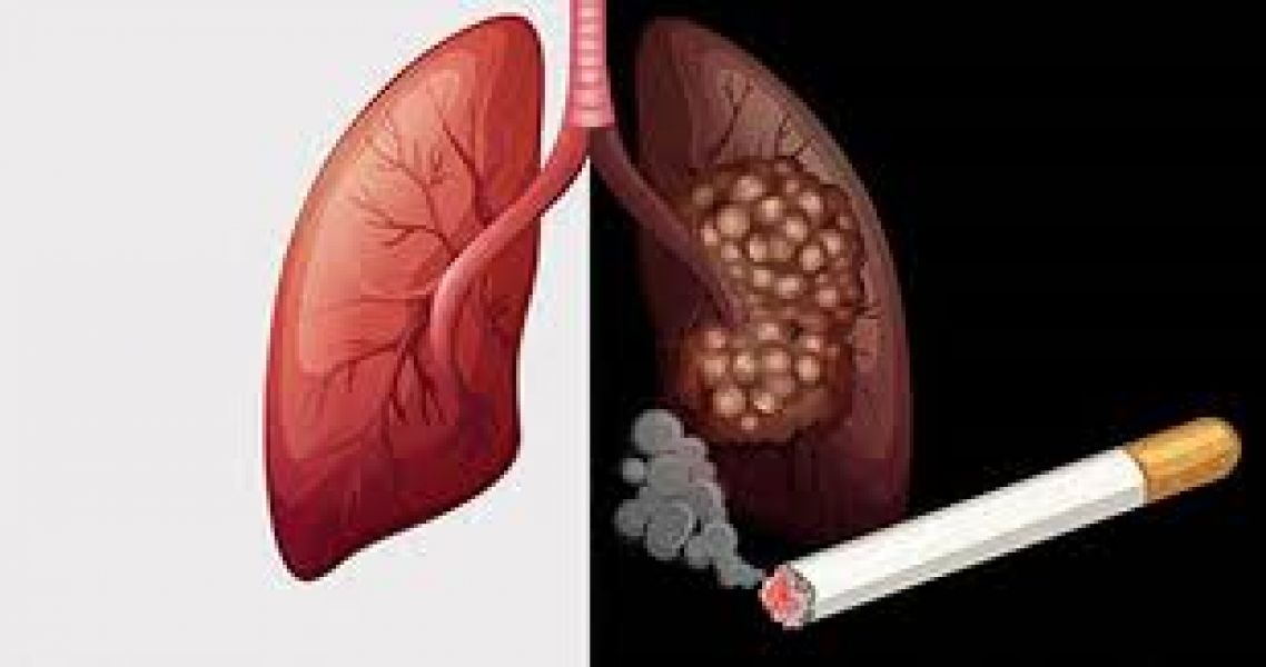 Tác hại của thuốc lá đối với sức khỏe